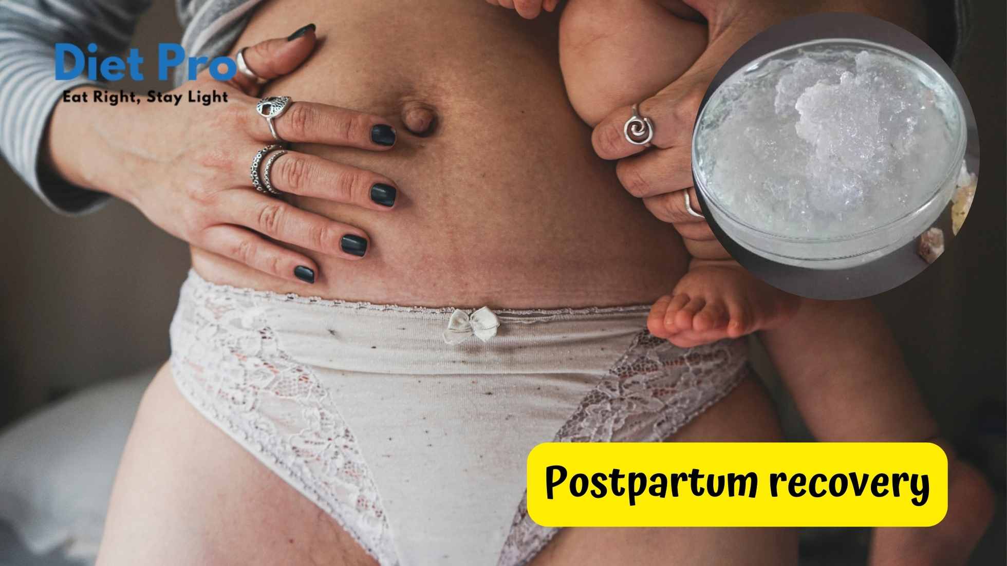 Postpartum recovery